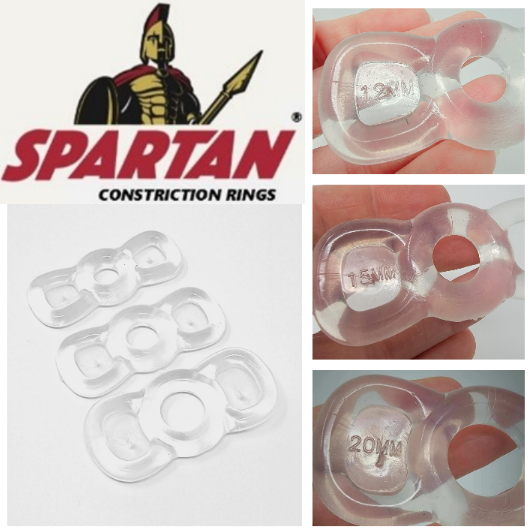 Spartan Constriction Rings for Enhanced VED Performance Spartan Constriction Rings for Enhanced VED Performance