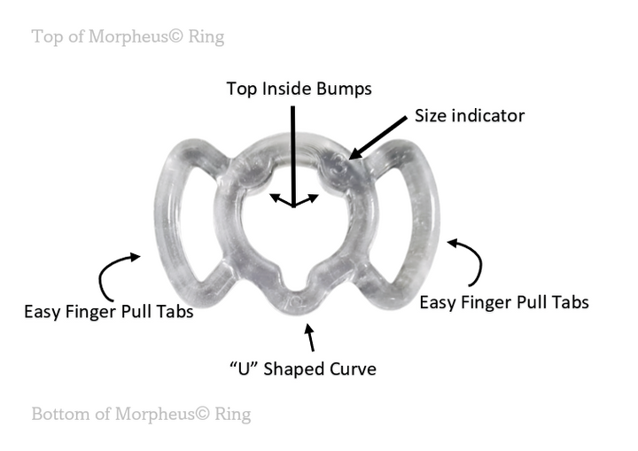 Morpheus Constriction Rings for Effective ED Support